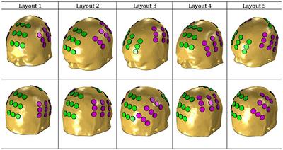 Temperature and Impedance Variations During Tumor Treating Fields (TTFields) Treatment